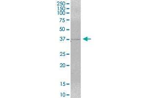 MRM1 MaxPab polyclonal antibody. (MRM1 抗体  (AA 1-353))