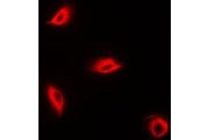 Immunofluorescent analysis of Perforin 1 staining in K562 cells. (Perforin 1 抗体)