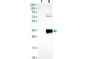 Western blot analysis of Lane 1: Negative control (vector only transfected HEK293T lysate), Lane 2: Over-expression Lysate (Co-expressed with a C-terminal myc-DDK tag (~3. (APIP 抗体)