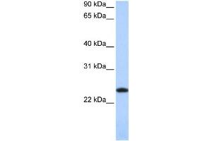 Western Blotting (WB) image for anti-Ferritin, Light Polypeptide (FTL) antibody (ABIN2459726) (FTL 抗体)