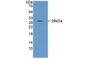 Detection of Recombinant CHRNe, Mouse using Polyclonal Antibody to Cholinergic Receptor, Nicotinic, Epsilon (CHRNe) (CHRNE 抗体  (AA 21-239))