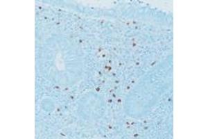 Immunohistochemical staining for paraffin-embedded human appendix section using Mast Cell Tryptase monoclonal antibody, clone 10D11 . (Mast Cell Tryptase 抗体)