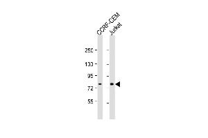 All lanes : Anti-ND5 Antibody (C-term) at 1:1000 dilution Lane 1: CCRF-CEM whole cell lysate Lane 2: Jurkat whole cell lysate Lysates/proteins at 20 μg per lane. (MT-ND5 抗体  (C-Term))