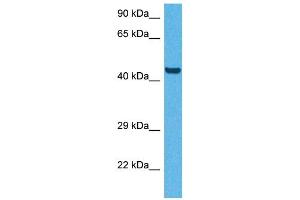 Host:  Rabbit  Target Name:  CD36  Sample Tissue:  Human HepG2 Whole Cell  Antibody Dilution:  1ug/ml (CD36 抗体  (N-Term))