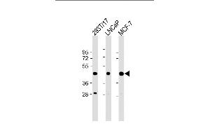 All lanes : Anti-PRMT6 (N-term) at 1:2000 dilution Lane 1: 293T/17 whole cell lysate Lane 2: LNCaP whole cell lysate Lane 3: MCF-7 whole cell lysate Lysates/proteins at 20 μg per lane. (PRMT6 抗体  (N-Term))