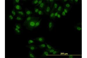 Immunofluorescence of monoclonal antibody to RBM9 on HeLa cell.