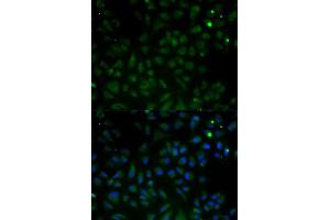 Immunofluorescence analysis of HeLa cells using VDAC1 antibody. (VDAC1 抗体  (AA 1-283))