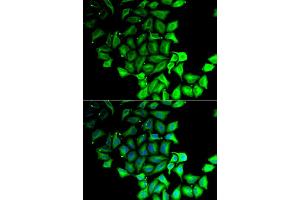Immunofluorescence analysis of MCF-7 cell using RPS7 antibody. (RPS7 抗体)