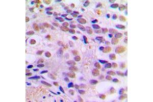 Immunohistochemistry (IHC) image for anti-cAMP Responsive Element Binding Protein 1 (CREB1) (pSer121) antibody (ABIN7295350)