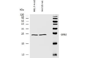 Western bloting analysis of human GRB2 using rabbit polyclonal antibody PAb (554) on lysates of MOLT-4 and RAMOS cell lines under reducing conditions. (GRB2 抗体  (AA 198-217))