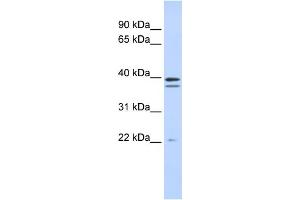 WB Suggested Anti-RABGGTB Antibody Titration:  0. (RABGGTB 抗体  (Middle Region))