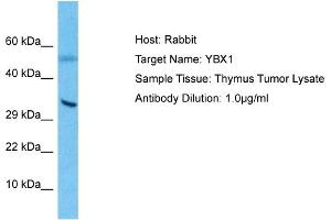 Host: Rabbit Target Name: YBX1 Sample Type: Thymus Tumor lysates Antibody Dilution: 1. (YBX1 抗体  (C-Term))