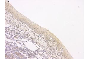 IHC analysis of SRCIN1 using anti-SRCIN1 antibody (ABIN6719623).