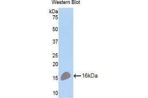 Western blot analysis of the recombinant protein. (BCMA 抗体  (AA 71-184))