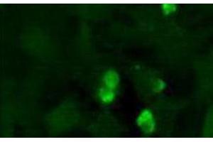 Immunofluorescence (IF) image for anti-Jumonji, AT Rich Interactive Domain 2 (JARID2) (AA 1-100), (N-Term) antibody (ABIN1951845) (JARID2 抗体  (N-Term))