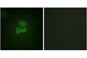 Immunofluorescence analysis of A549 cells, using PKD1/PKC mu (Ab-205) Antibody. (PKC mu 抗体  (AA 171-220))