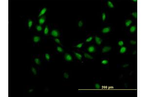 Immunofluorescence of purified MaxPab antibody to C7orf16 on HeLa cell. (G Substrate 抗体  (AA 1-155))