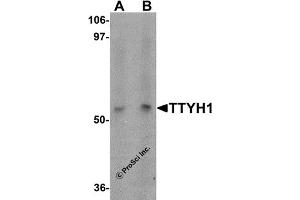 Western Blotting (WB) image for anti-Tweety Homolog 1 (TTYH1) (C-Term) antibody (ABIN1030786) (TTYH1 抗体  (C-Term))