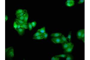 Immunofluorescence staining of HepG2 cells with ABIN7144603 at 1:66, counter-stained with DAPI. (ATE1 抗体  (AA 105-253))