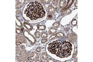 Immunohistochemical staining of human kidney with LDLRAD2 polyclonal antibody  shows distinct cytoplasmic and membranous positivity in cells in glomeruli at 1:200-1:500 dilution. (LDLRAD2 抗体)