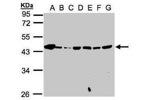 WB Image Sample(30μg whole cell lysate) A: 293T B: A431 , C: H1299 D: HeLa S3 , E: Hep G2 , F: MOLT4 , G: Raji , 10% SDS PAGE antibody diluted at 1:1000 (MPI 抗体)