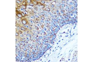 Immunohistochemistry of paraffin-embedded Human esophageal using WWC1 Rabbit pAb (ABIN7271388) at dilution of 1:100 (40x lens). (WWC1 抗体  (AA 950-1050))