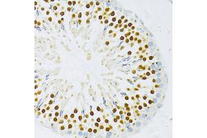 Immunohistochemistry of paraffin-embedded rat testis using DP1/DP1/TFDP1 antibody (ABIN7270892) at dilution of 1:100 (40x lens). (DP1 抗体  (AA 1-290))