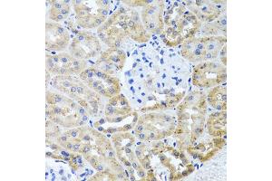 Immunohistochemistry of paraffin-embedded rat kidney using HDAC6 antibody (ABIN1872957) at dilution of 1:100 (40x lens). (HDAC6 抗体)