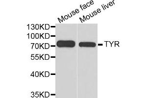 Western blot analysis of extracts of mouse face and mouse liver  tissues, using TYR antibody. (TYR 抗体)