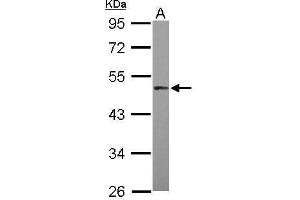 WB Image Sample (30 ug of whole cell lysate) A: HepG2 10% SDS PAGE antibody diluted at 1:1000 (MAPKAP Kinase 5 抗体)