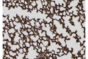 ABIN6256548 and ABIN6277774 at 1/100 staining Mouse lung tissue by IHC-P.