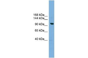 WB Suggested Anti-VPS41 Antibody Titration: 0. (VPS41 抗体  (Middle Region))
