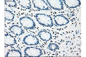 Immunohistochemical staining of paraffin-embedded Kidney tissue using anti-CHEK2mouse monoclonal antibody. (CHEK2 抗体)