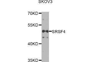 Western blot analysis of extracts of SKOV3 cells, using SRSF4 antibody (ABIN5974197) at 1/1000 dilution. (SRSF4 抗体)