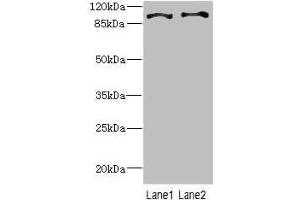 Western blot All lanes: CCP110 antibody at 4. (CG1331 Gene Product From Transcript CG1331-RA (CCP84AF) (AA 1-280) 抗体)