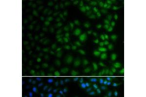 Immunofluorescence analysis of A549 cells using NAA40 Polyclonal Antibody (NAA40 抗体)