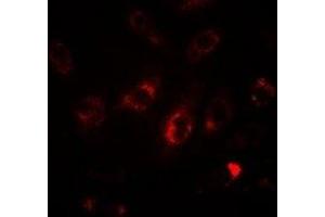 Immunofluorescent analysis of LC3A staining in HepG2 cells.