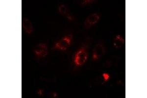 Immunofluorescent analysis of LC3A staining in HepG2 cells. (MAP1LC3A 抗体)