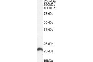 (ABIN302138) (0. (GTPase NRas 抗体  (Internal Region))