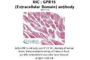 Image no. 1 for anti-G Protein-Coupled Receptor 15 (GPR15) (2nd Extracellular Domain) antibody (ABIN1734958) (GPR15 抗体  (2nd Extracellular Domain))