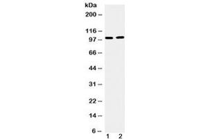 Western blot testing of 1) mouse testis and 2) human U87 cell lysate with TACC1 antibody at 0. (TACC1 抗体  (AA 196-235))