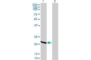 Western Blot analysis of RCV1 expression in transfected 293T cell line by RCV1 monoclonal antibody (M42A), clone 3H1. (Recoverin 抗体  (AA 91-181))