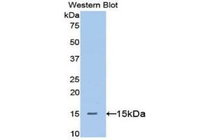 Western blot analysis of the recombinant protein. (Betacellulin 抗体  (AA 32-118))