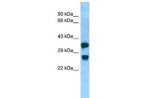 Host:  Rabbit  Target Name:  Aqp8  Sample Type:  Rat Small Intestine lysates  Antibody Dilution:  1. (Aquaporin 8 抗体  (Middle Region))