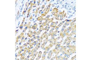 Immunohistochemistry of paraffin-embedded human liver using LRPPRC antibody at dilution of 1:100 (40x lens). (LRPPRC 抗体)