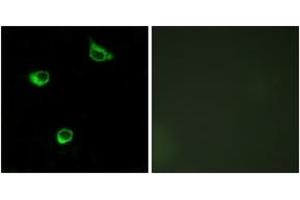 Immunofluorescence (IF) image for anti-Frizzled Family Receptor 6 (FZD6) (AA 121-170) antibody (ABIN2890782) (FZD6 抗体  (AA 121-170))