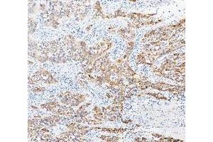 IHC analysis of Cytokeratin 20/Krt20 using anti-Cytokeratin 20/Krt20 antibody (ABIN7601133). (KRT20 抗体  (AA 29-431))