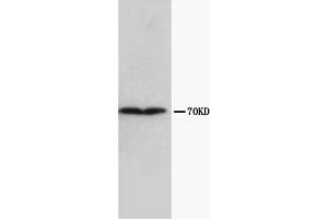 Western Blotting (WB) image for anti-Collagen, Type III, alpha 1 (COL3A1) (Chain alpha 1) antibody (ABIN1106750) (COL3A1 抗体  (Chain alpha 1))