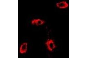 Immunofluorescent analysis of RAB11A staining in MCF7 cells. (RAB11A 抗体)