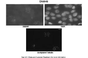 Immunohistochemistry (IHC) image for anti-Dynein, Axonemal, Heavy Chain 9 (DNAH9) (C-Term) antibody (ABIN2790246) (DNAH9 抗体  (C-Term))